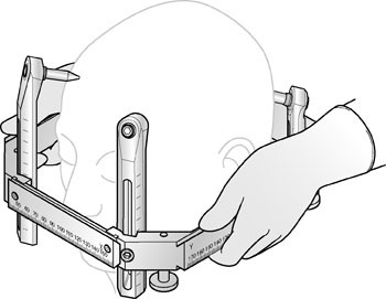 Stereotactic frame positioning
