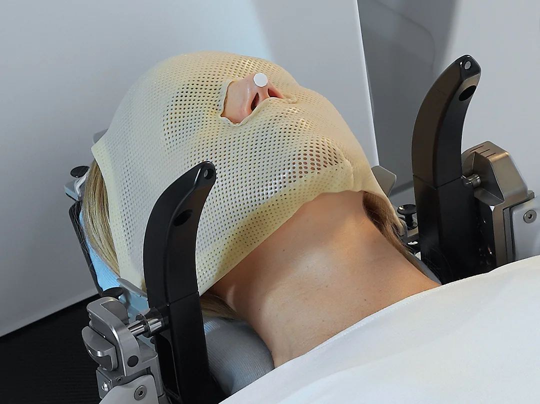 Custom thermoplastic mask for Gamma Knife treatment
